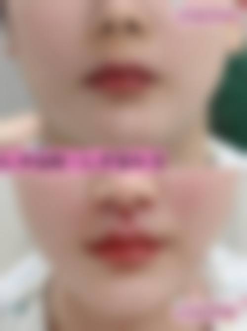 揭阳市东山区第二医院门诊营业时间。