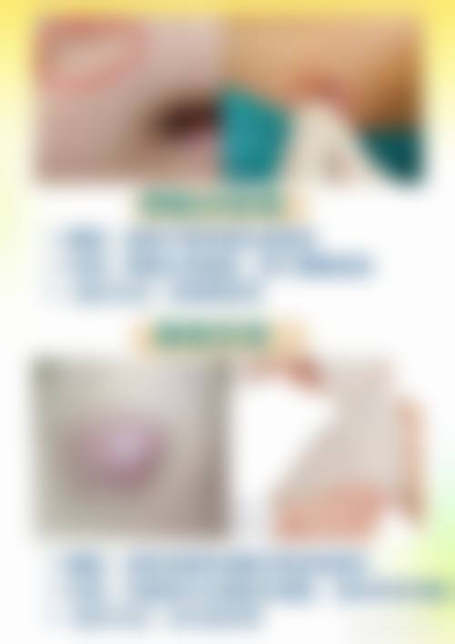 宁波海曙美焕整形医院温馨提示——为了节省您的时间，看诊前请预约哦！