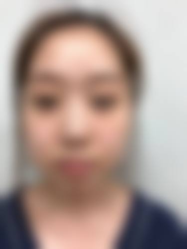 北京艾玛医疗美容医院正规可靠吗？