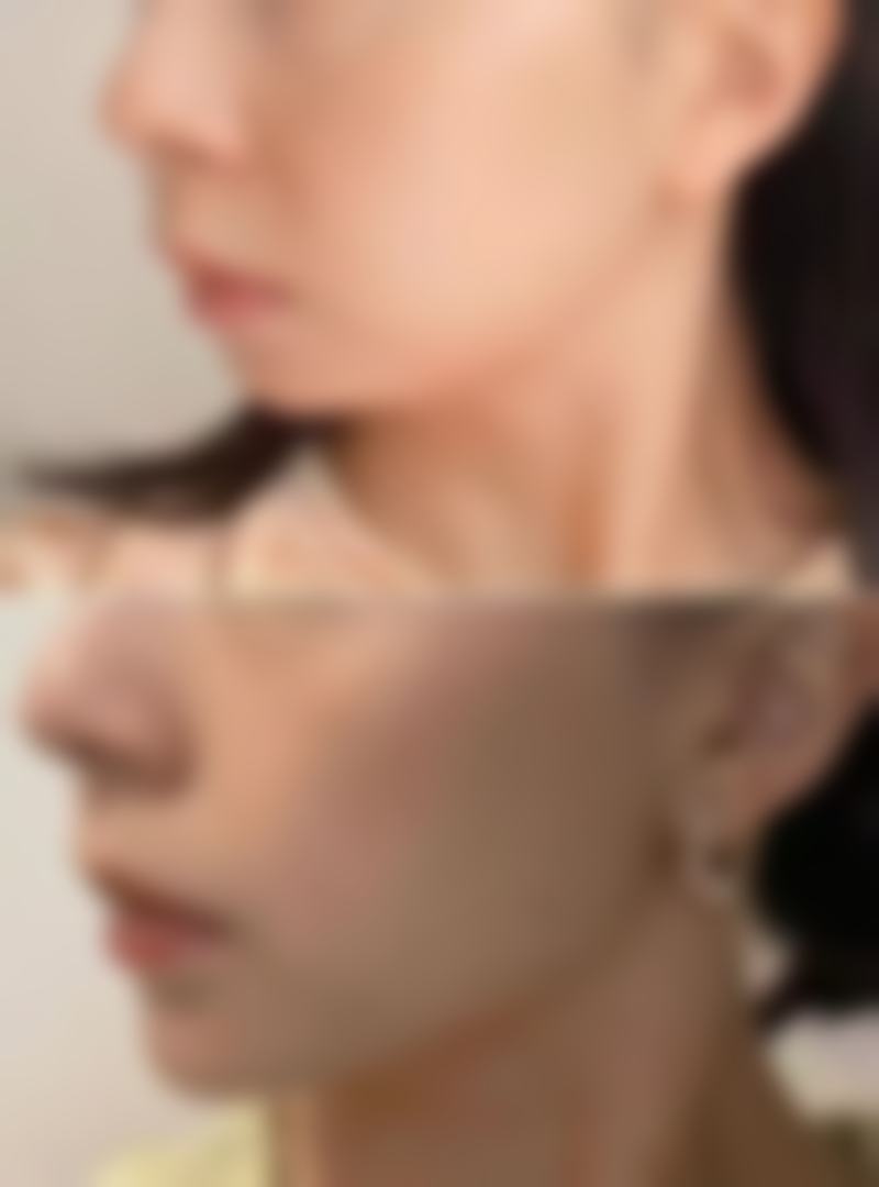 北京臻瑞尚美医疗美容诊所擅长项目