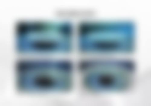 人工晶体植入可以当兵吗？深度解析军检标准与ICL术后考军校的真实可能性