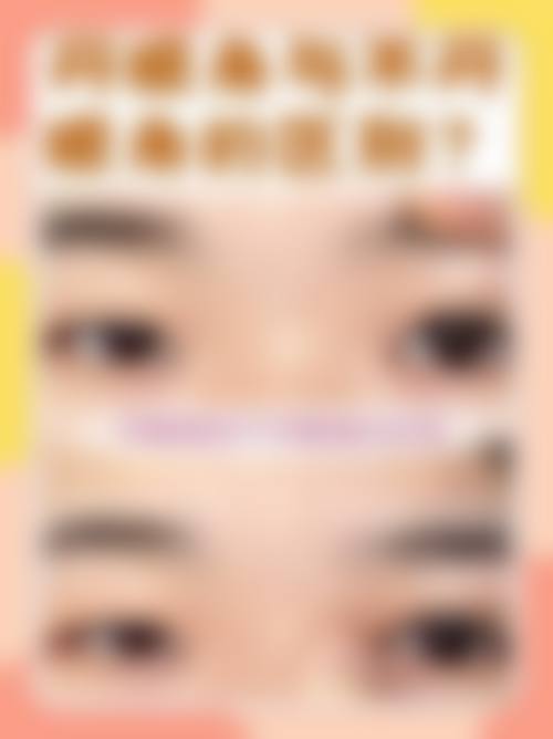 五、内外双眼皮对眼睛视觉成效有何影响？