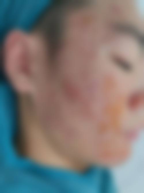 2、【胸部整形】核心技术优势