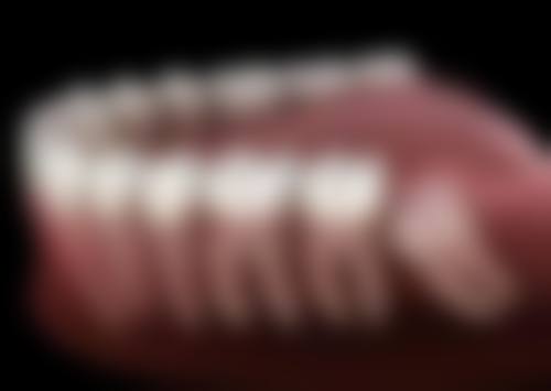 深圳佳美口腔洗牙分享2026最新收费标准！舒适洁牙一次多少钱？靠谱体验测评