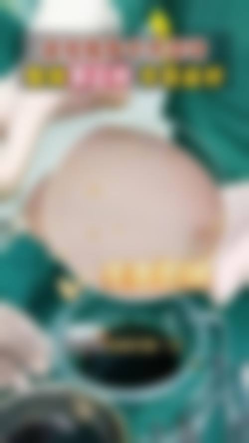 韓國隆胸術後護理要訣:隱藏細節大公開