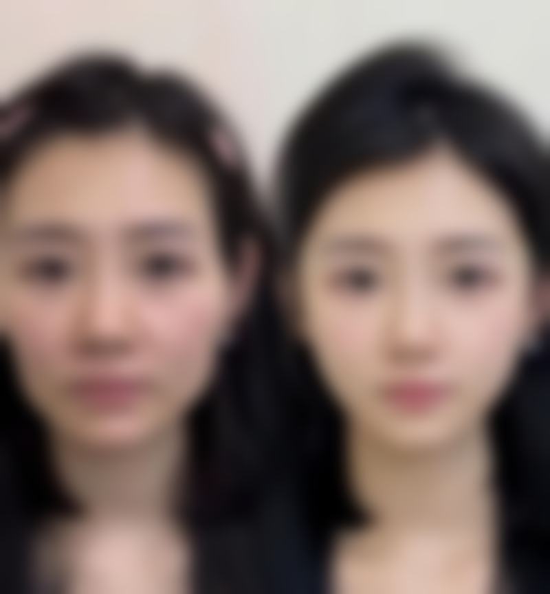 shinebom皮膚科怎麼預約掛號 2026年更啱港澳人的方法:BeautsGO APP中文預約攻略