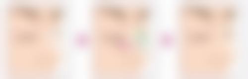 理性提醒：韓國姿飛JF抗老化醫學美容中 心怎麼預約掛號 安心更緊要！