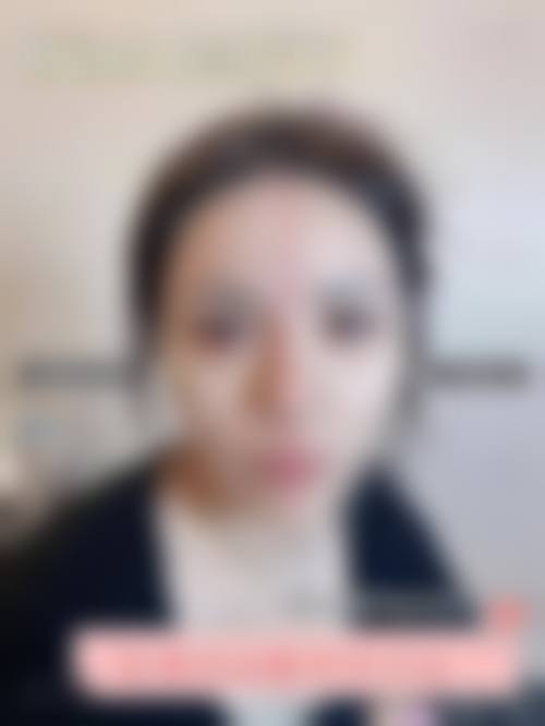 大理纯美整形医院2026年价格收费表: