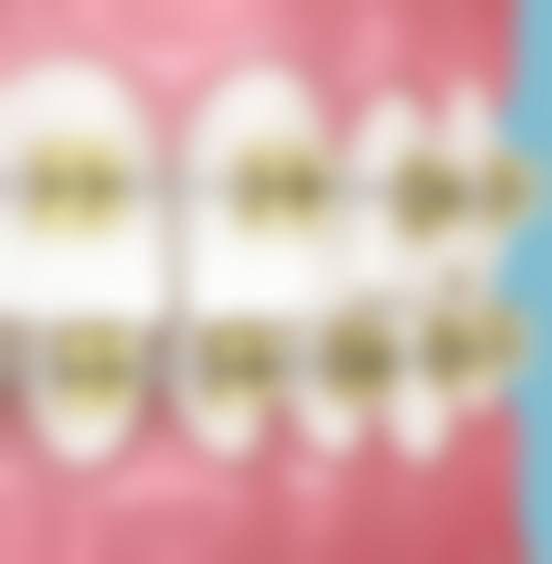 东莞长安雅健口腔门诊预约挂号方式。