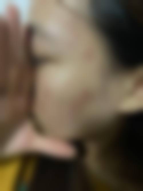 大理纯美整形医院治疗反馈与口碑评价。