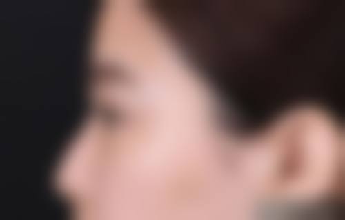 广州市新光医学美容整形门诊部擅长项目。