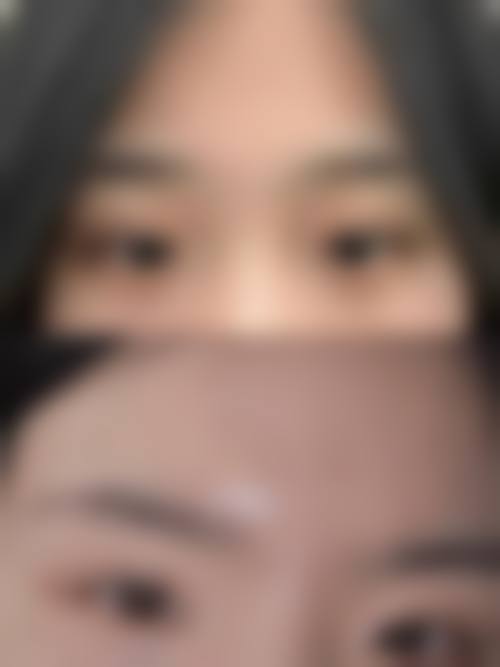 南京熙而美整形医院擅长项目
