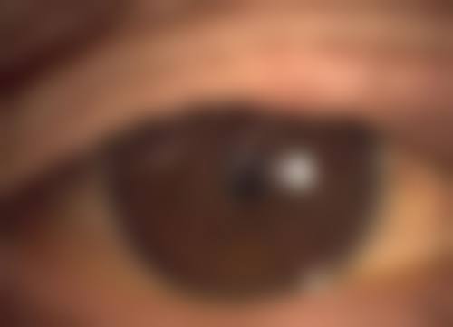 剑阁县人民医院眼科门诊营业时间。