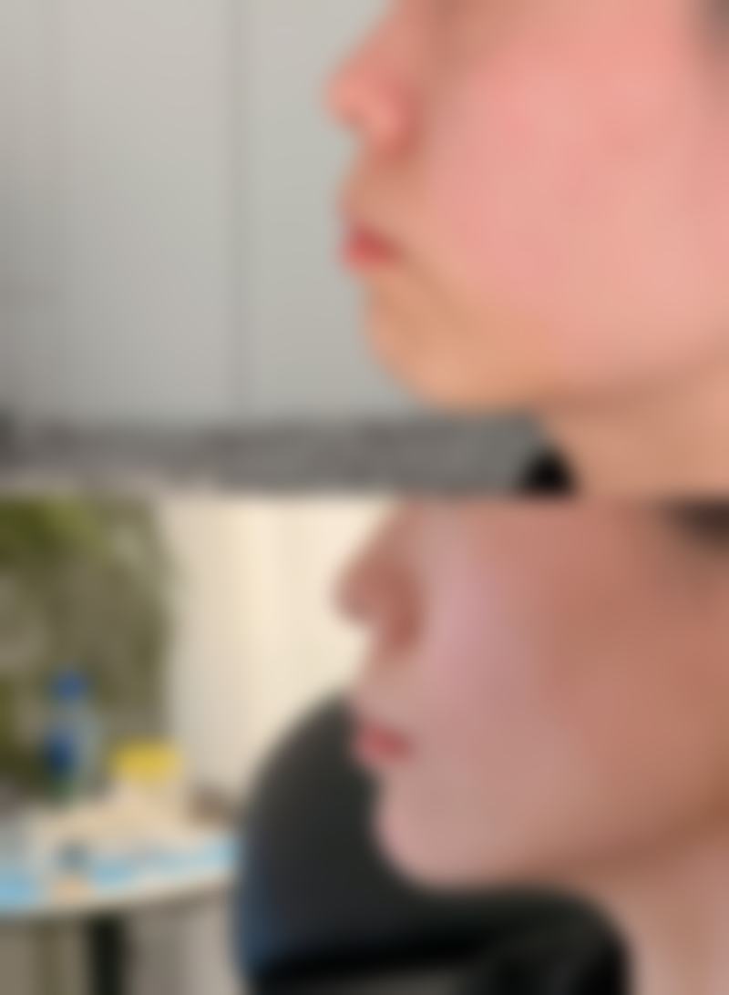 大理纯美整形医院预约挂号方式。