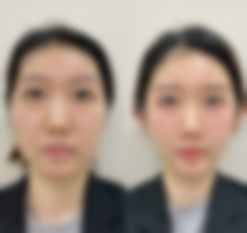 韩国JH整形医院门诊营业时间。