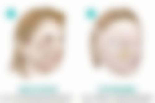 十一、彦根Liara Clinic预约挂号