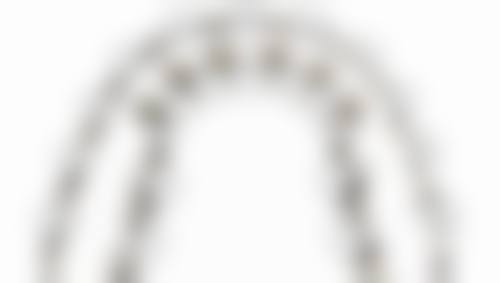 五、种植牙的成效与年龄有何关联?