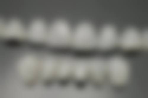 香港大學深圳醫院牙齒矯正收費2026最新！一文睇清正畸費用及價錢大公開