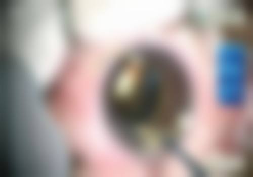 皖西卫生职业学院附属医院眼科特色技术优势及特色技术服务