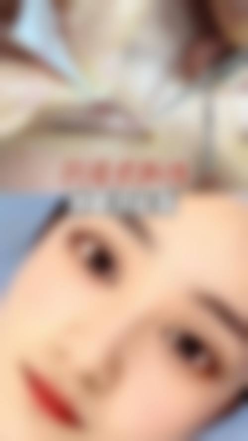 五、精切双眼皮安心吗 / 有哪些风险