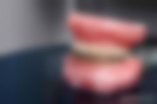 四、种植牙的费用与年龄有什么关系?