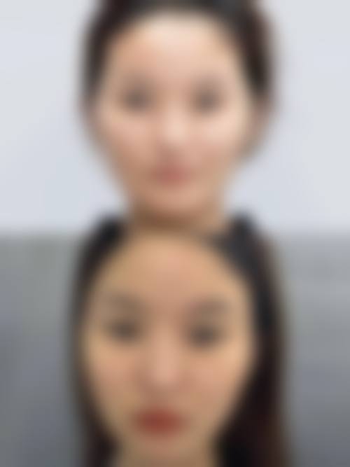 总结与预约号召