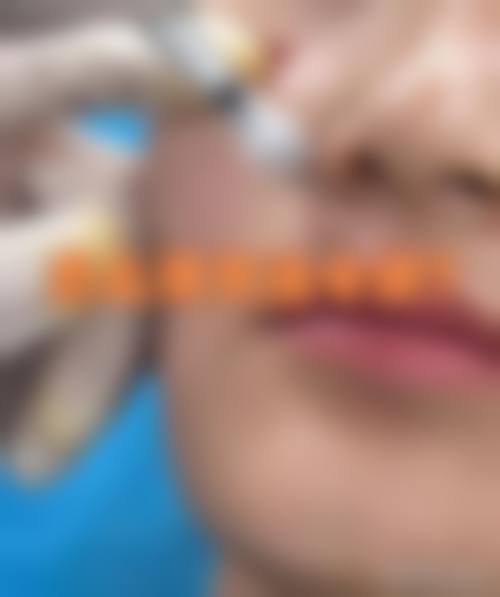 厦门修志夫整形医院治疗反馈与口碑评价。