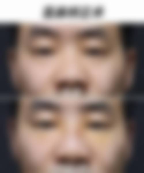 八、患者常见问题解答（精选 ）