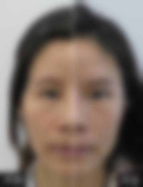 南宁星范医疗美容医生团队经验稳定。