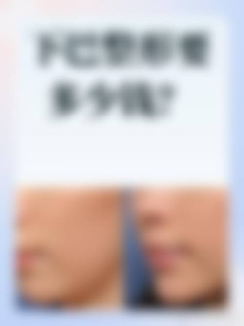张媛丽医生擅长的项目