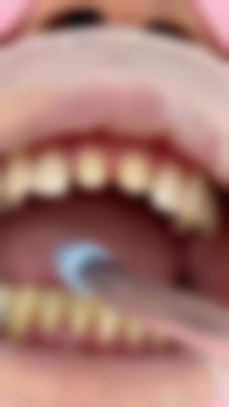 丽水缙云惠雅口腔诊所预约挂号方式。