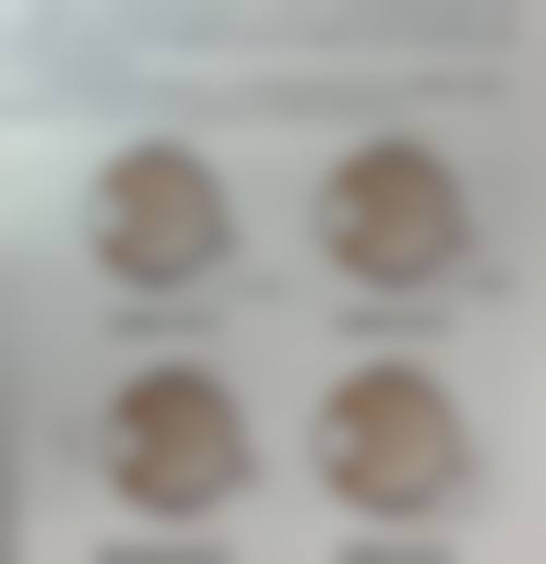 优惠活动详情——多种项目限时特价