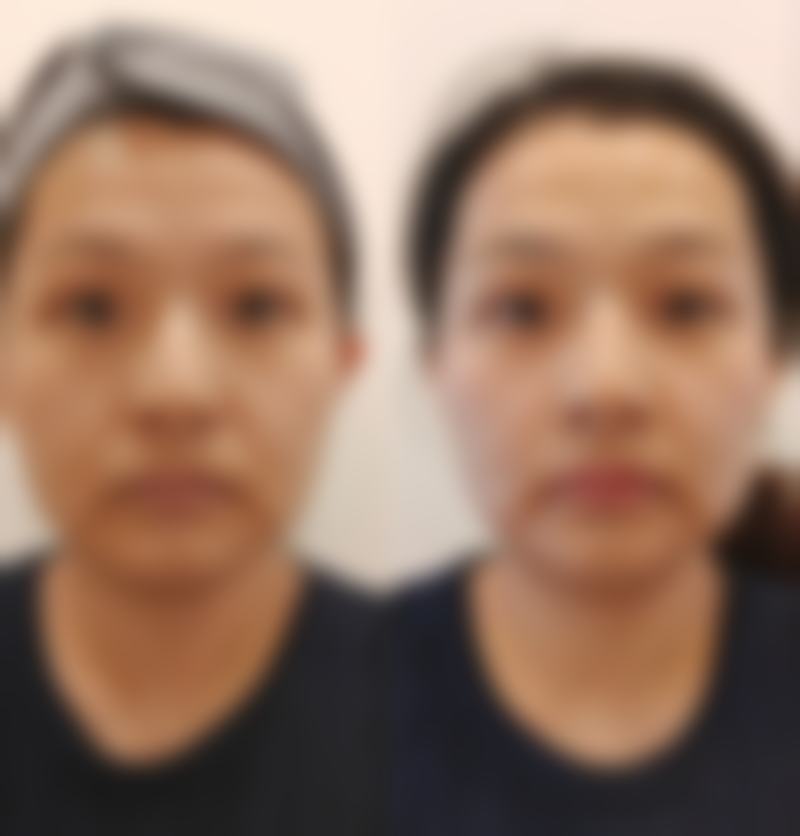 洛阳雍禾医疗美容诊所擅长的项目