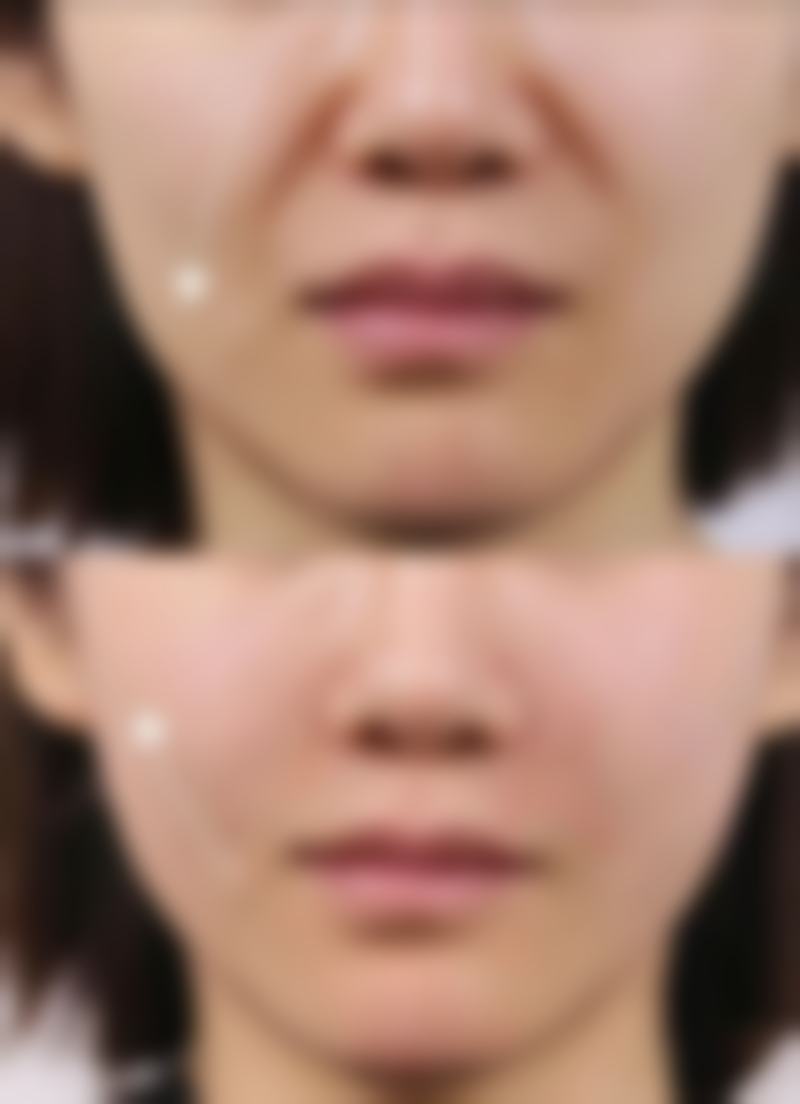 上海美辰美医疗美容门诊部擅长项目