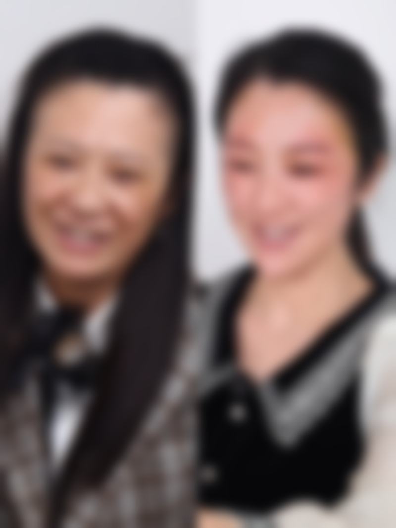韓國削骨術後多久消腫:真實实例分享