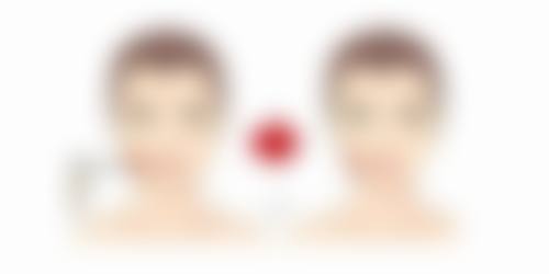 八、患者常见问题解答(精选 )