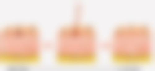 拓展延伸:韓國雙眼皮恢復日記ptt 項目真相+關鍵選擇點+避坑指南