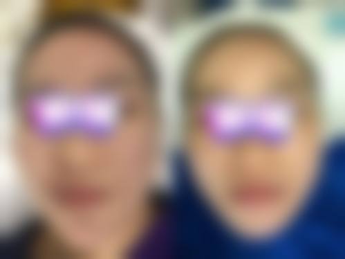 太原嘿象整形医院预约挂号方式。