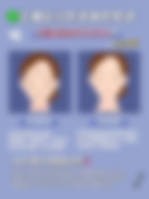 镇江博康整形美容医院擅长项目。