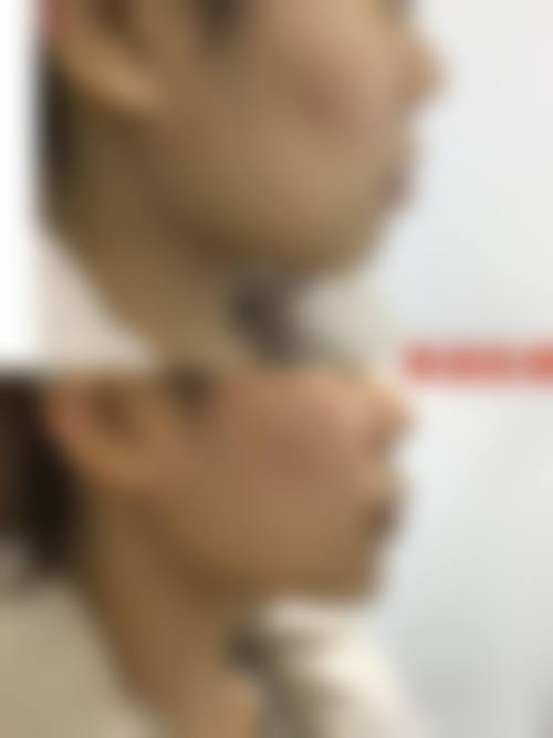 石强威医生技术实力