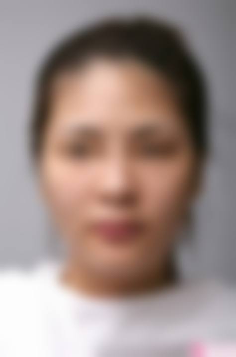 西安针美汇医疗美容诊所2026年价格收费表：