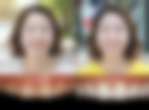 十一、郑州植得口腔医院(大学路院区)真人口碑实例评价一览