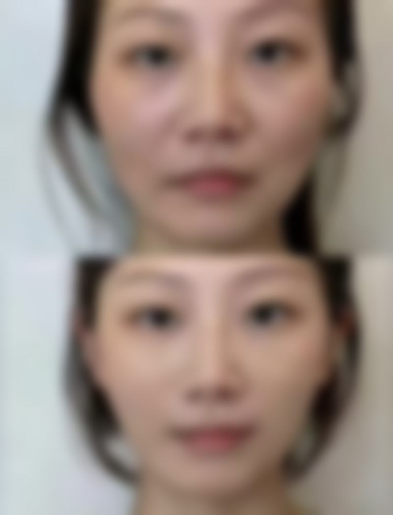 深圳肌小简医疗美容诊所乘车路线