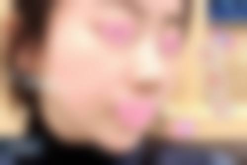 韓國原辰輪廓手術推薦:醫生邊個好?技術有咩特別?