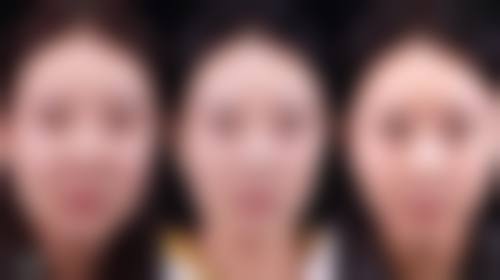 韓國angelmi皮膚科價格表2026中韓報價 價錢大對比!邊個更抵?
