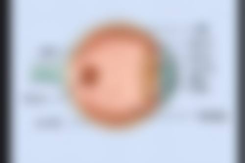通化眼科医院诊疗项目