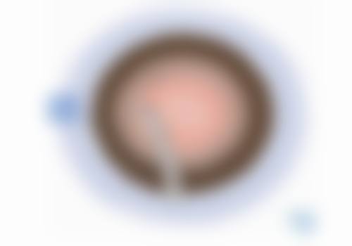 二、600度近视老了会瞎吗?不必恐慌!