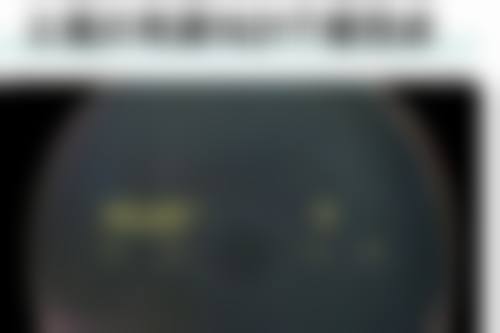 六、北京至旻至亮眼科诊所价格表/收费标准一览