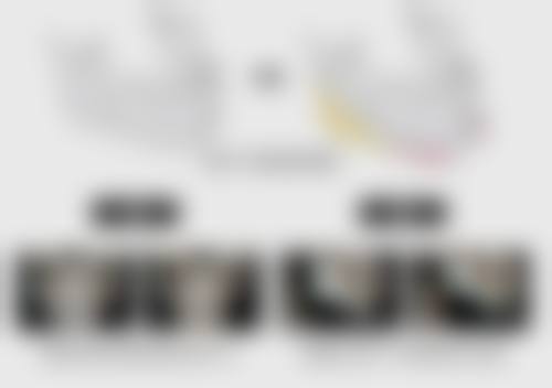 韓國原辰輪廓手術推薦2026｜醫生/價錢表/內地差異全解析