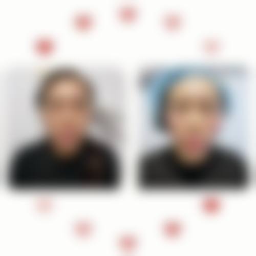 韩国美艺整形医院擅长项目。